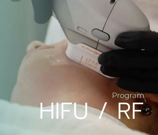 HIFU RF lifting at So Cute Clinic Thonglor Bangkok