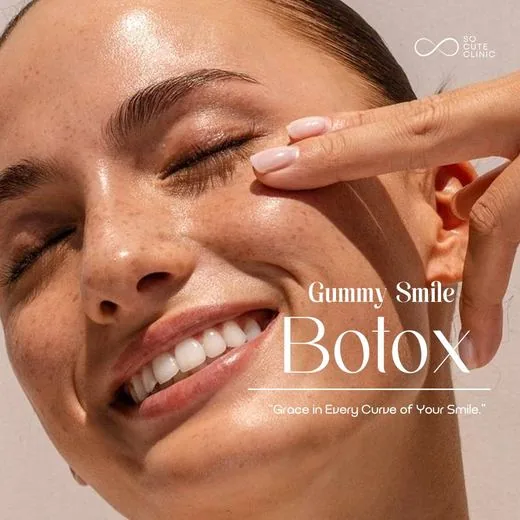 Gummy Smile Botox